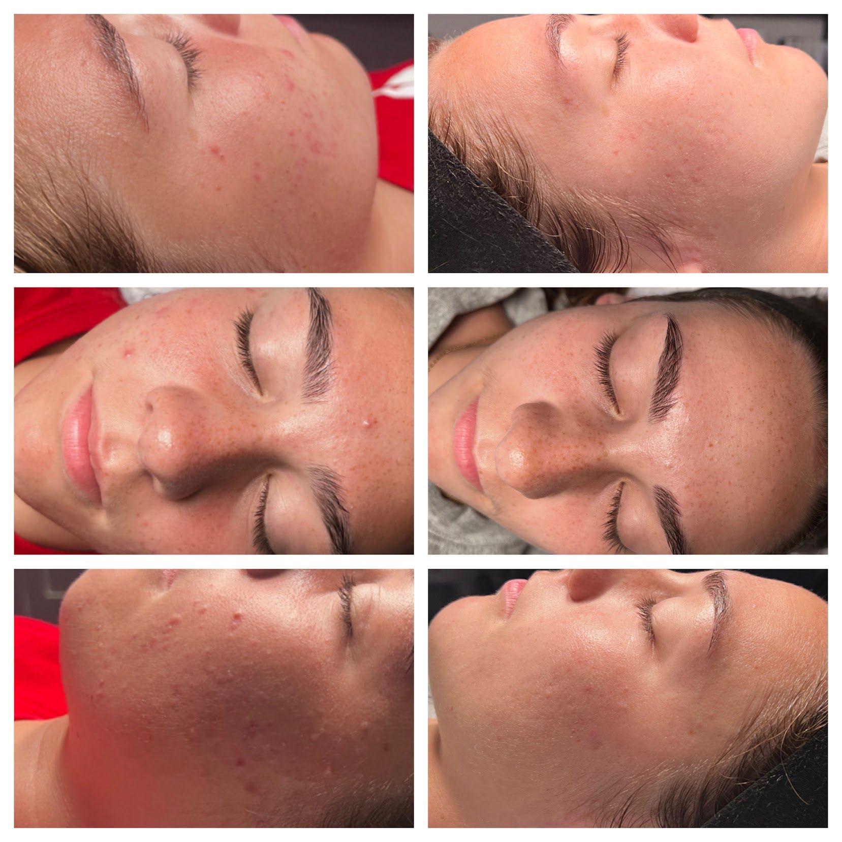 Six-panel collage of a person’s face, showing makeup or skincare close-ups on a red background