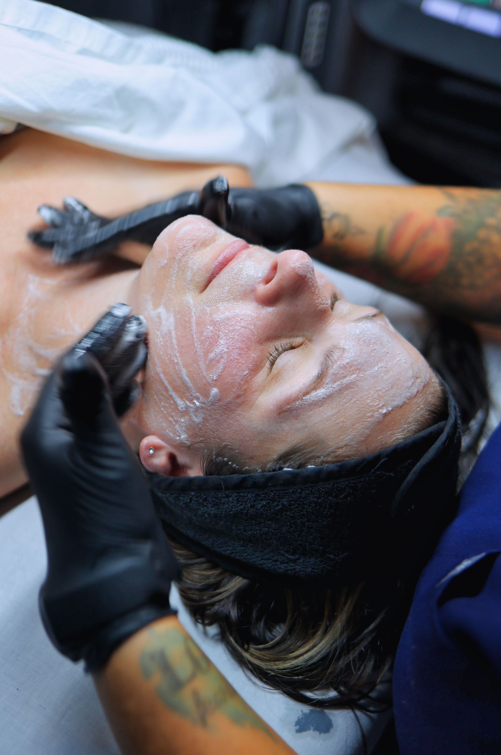 Chemical exfoliation peel treatment at Hans Esthetics in Plainfield, IL