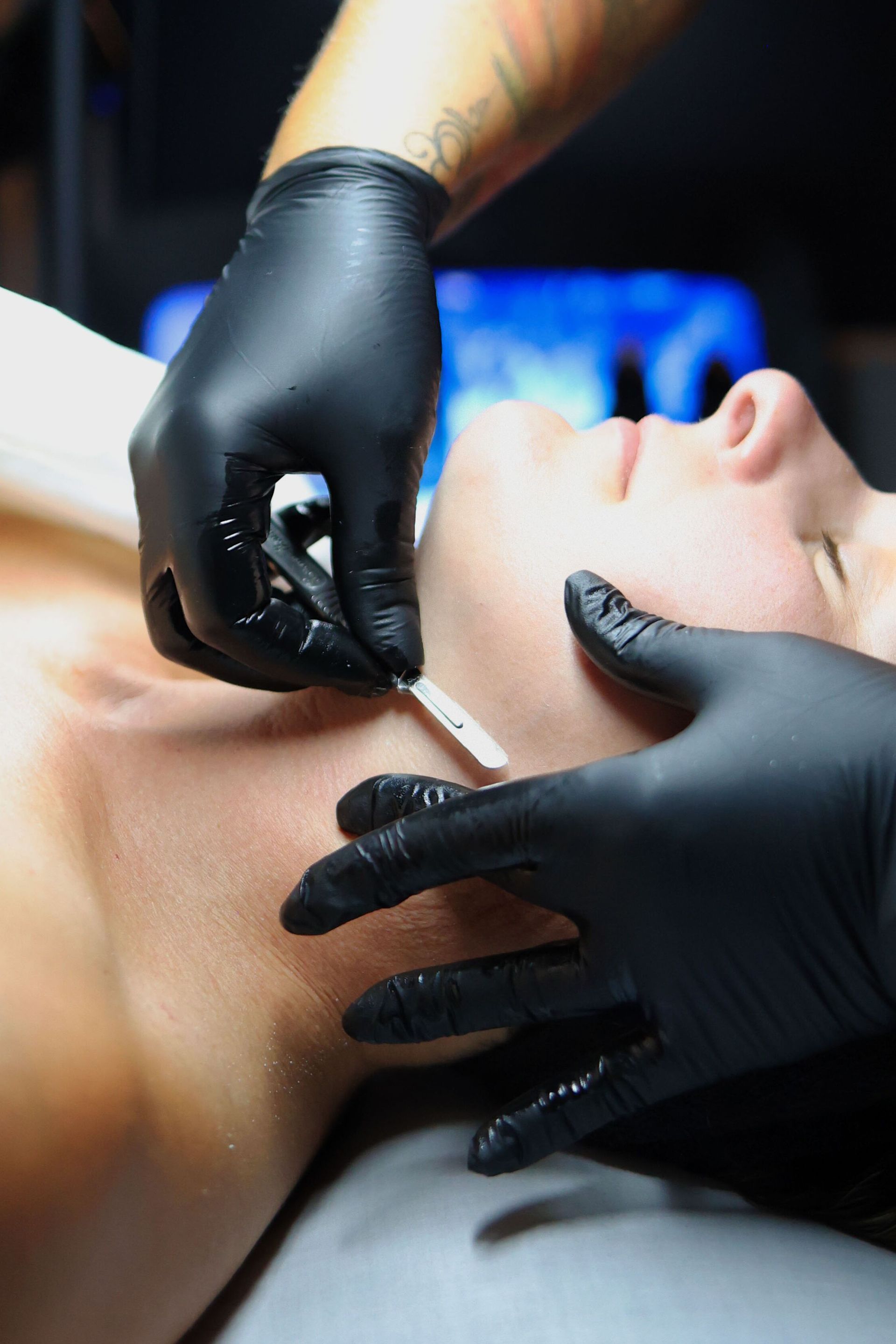 Dermaplaning add-on treatment at Hans Esthetics in Plainfield, IL