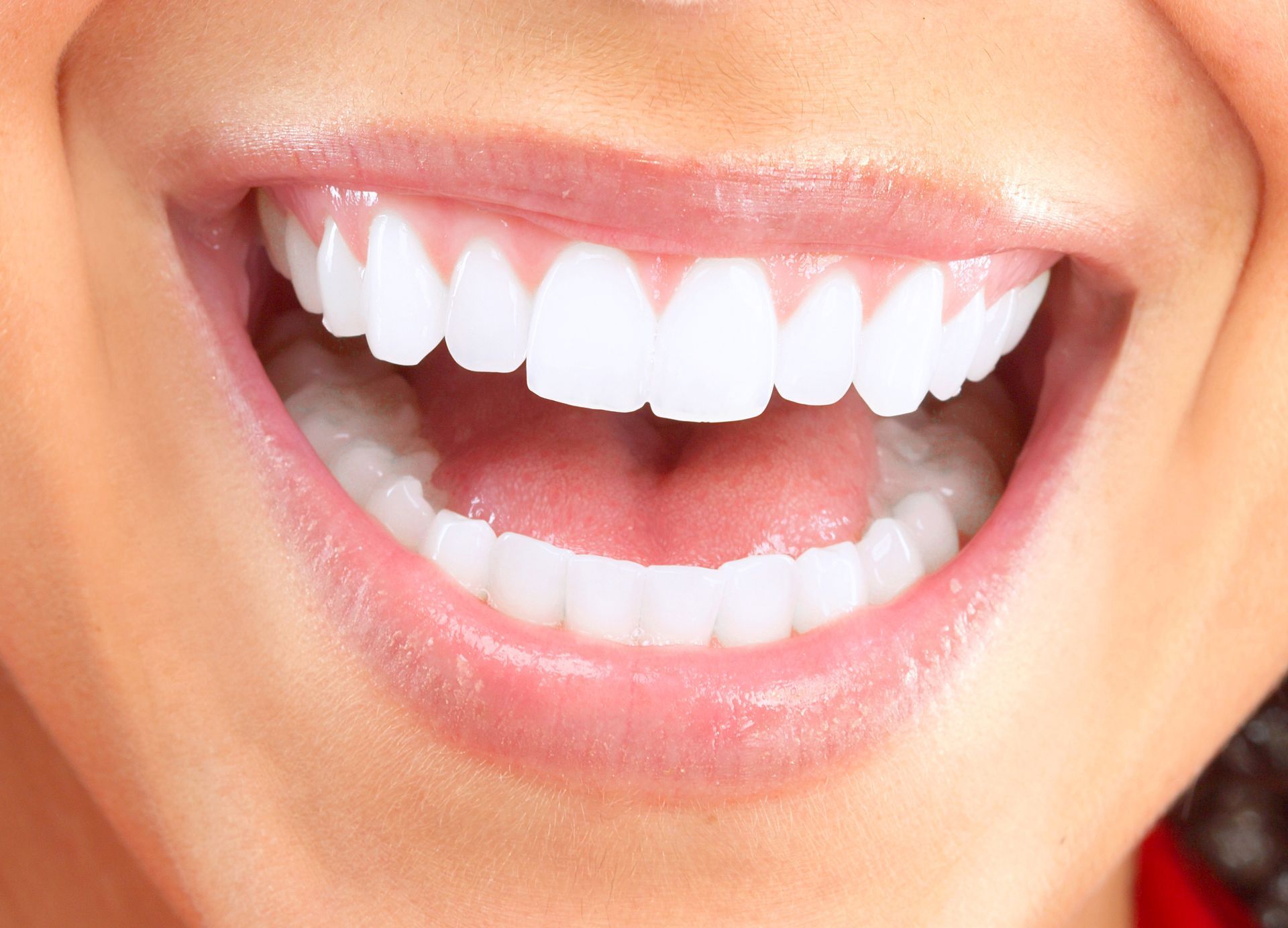 A close up of a woman 's teeth with her mouth open.