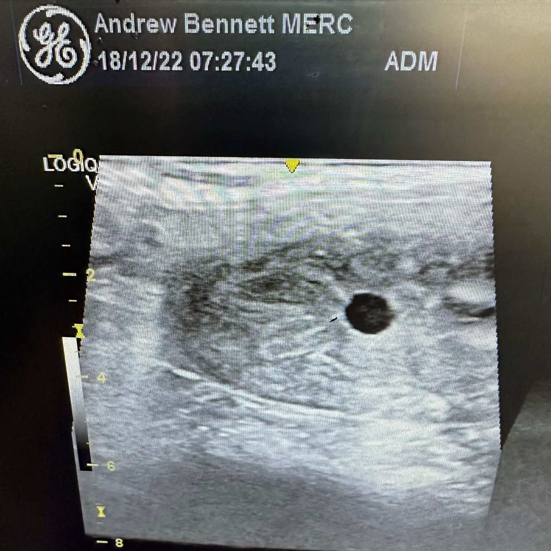 Horse Embryo Transfer Kempsey Macleay Valley Veterinary Services