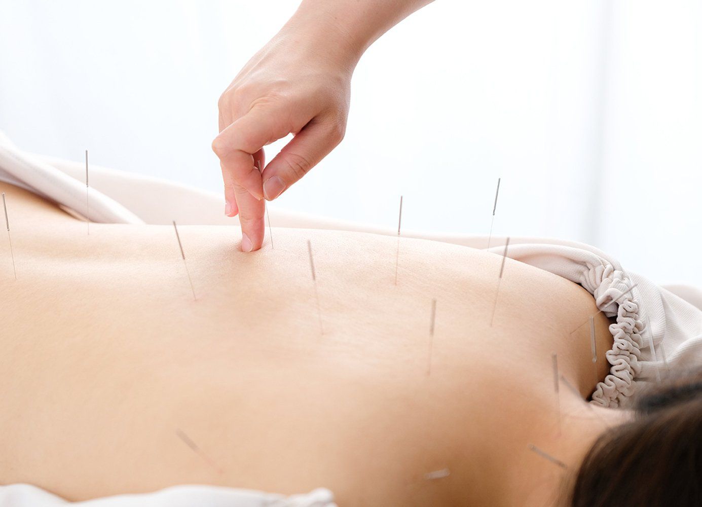Person receiving acupuncture treatment on their back, with needles inserted and a hand pointing.