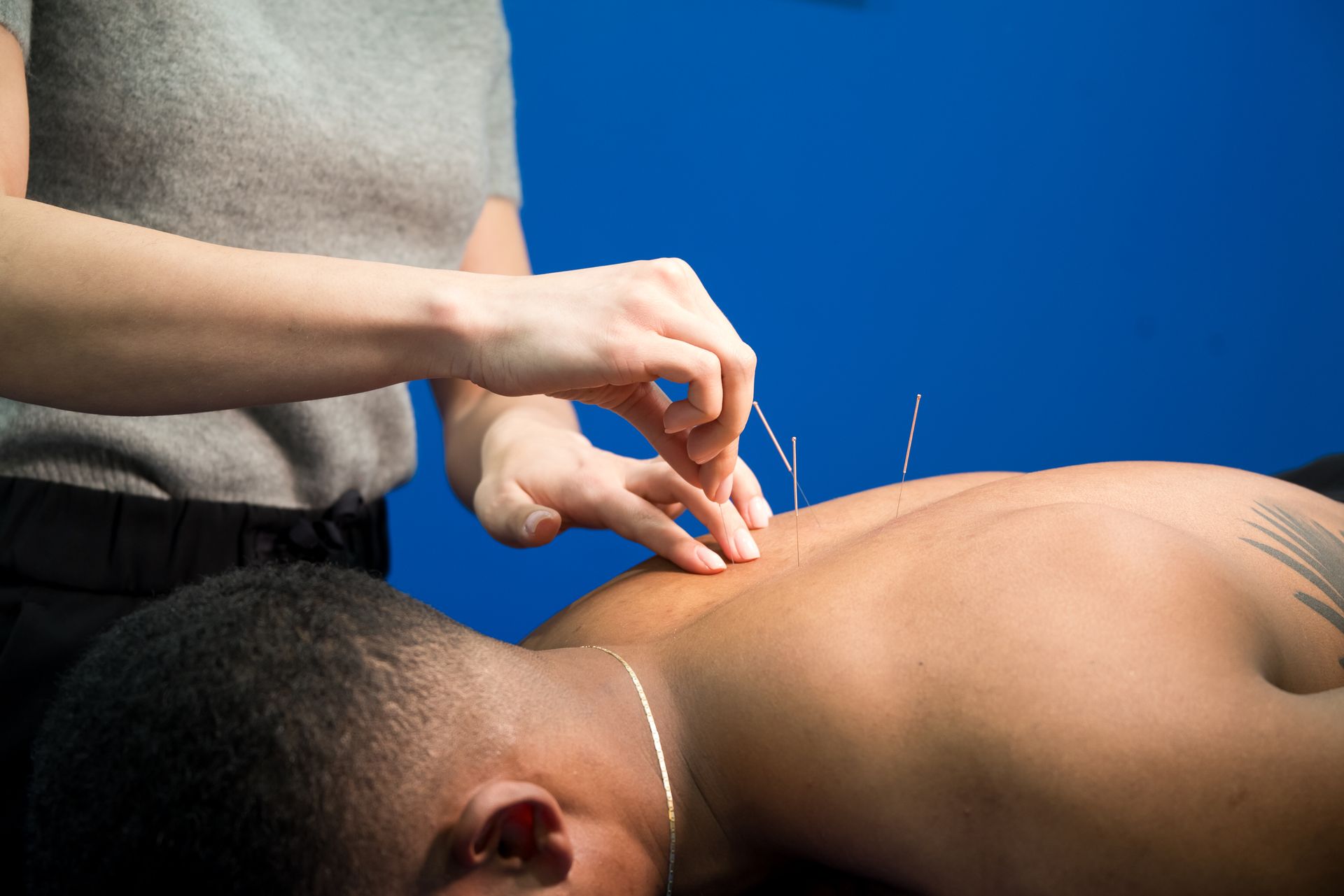medical acupuncture used for mid back pain