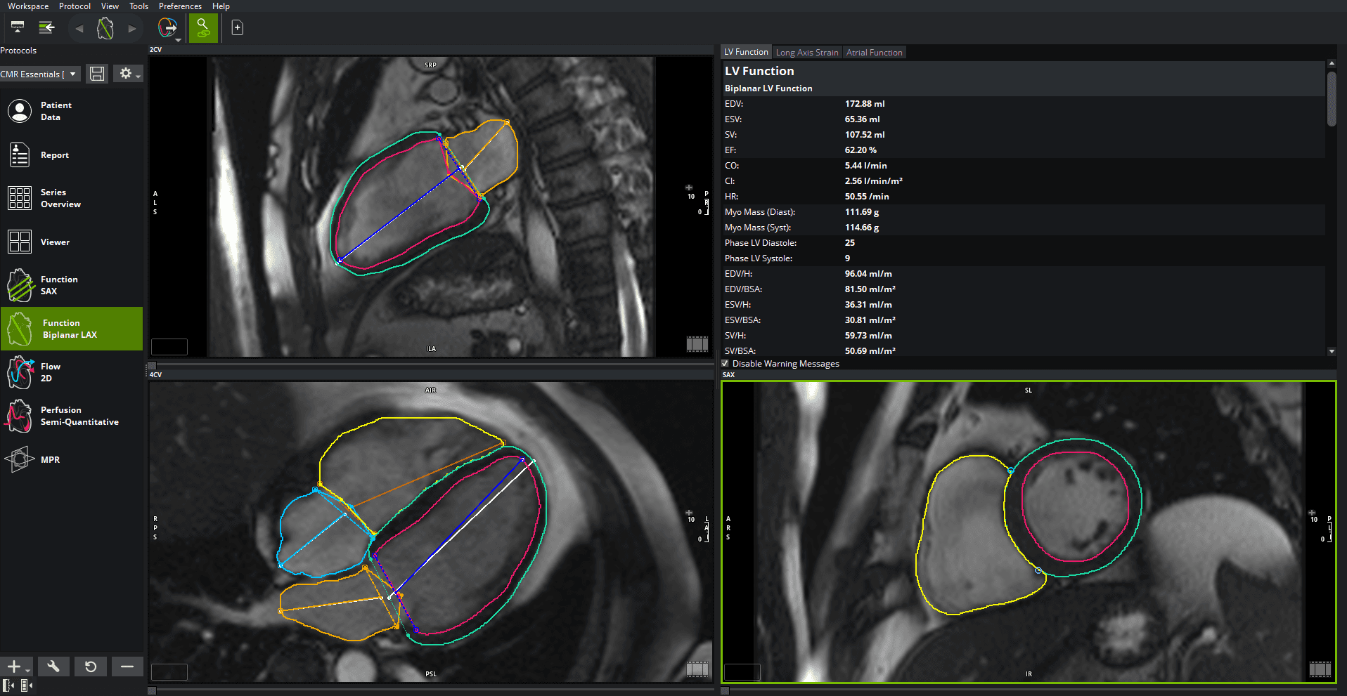 Cardiac Imaging Software | Circle Cardiovascular Imaging (Circle CVI)