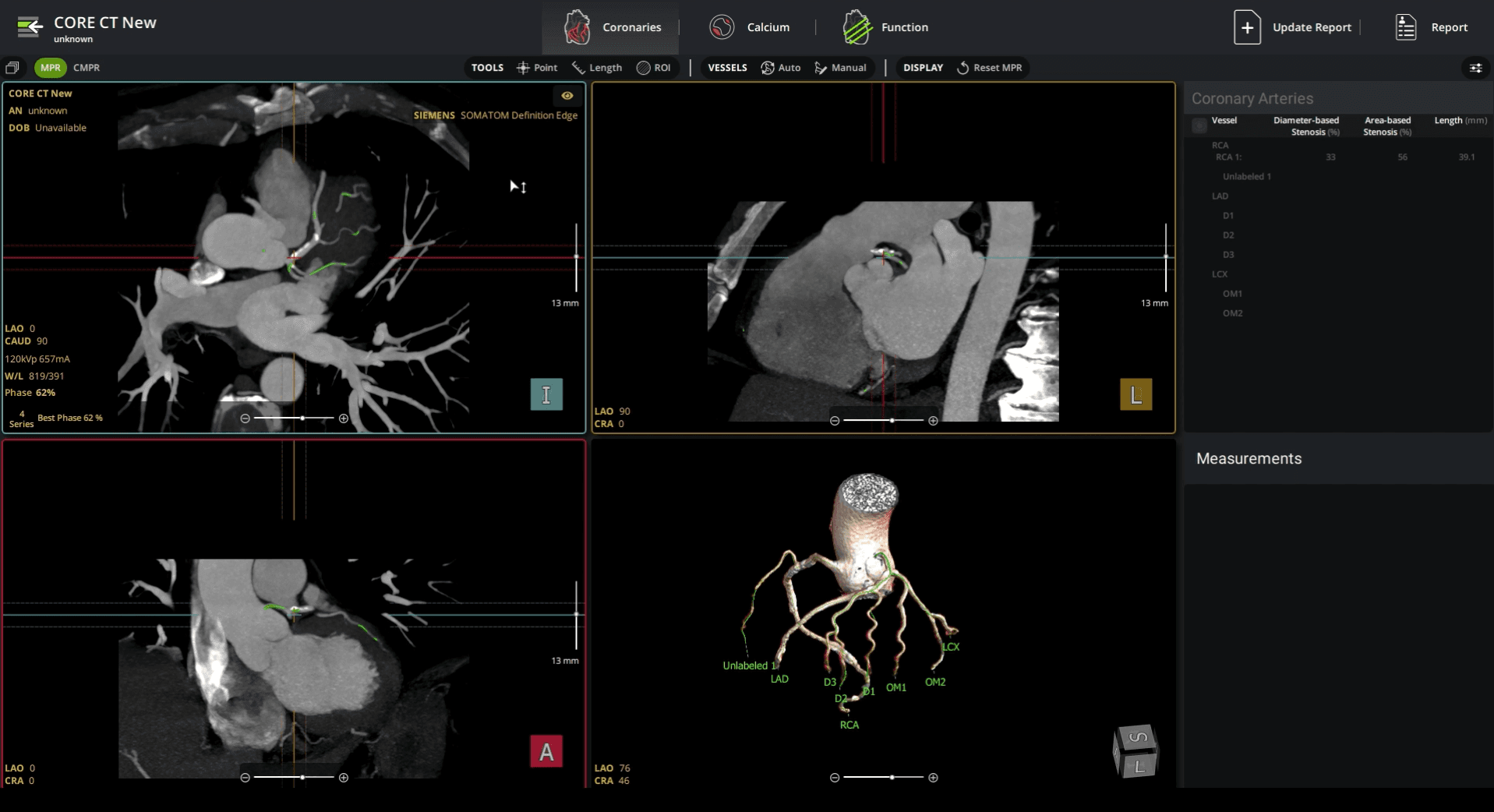 Cardiac Imaging Software | Circle Cardiovascular Imaging (Circle CVI)