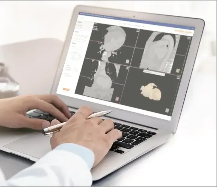 A healthcare professional using a laptop to view medical 3D imaging software, featuring scans of a heart.