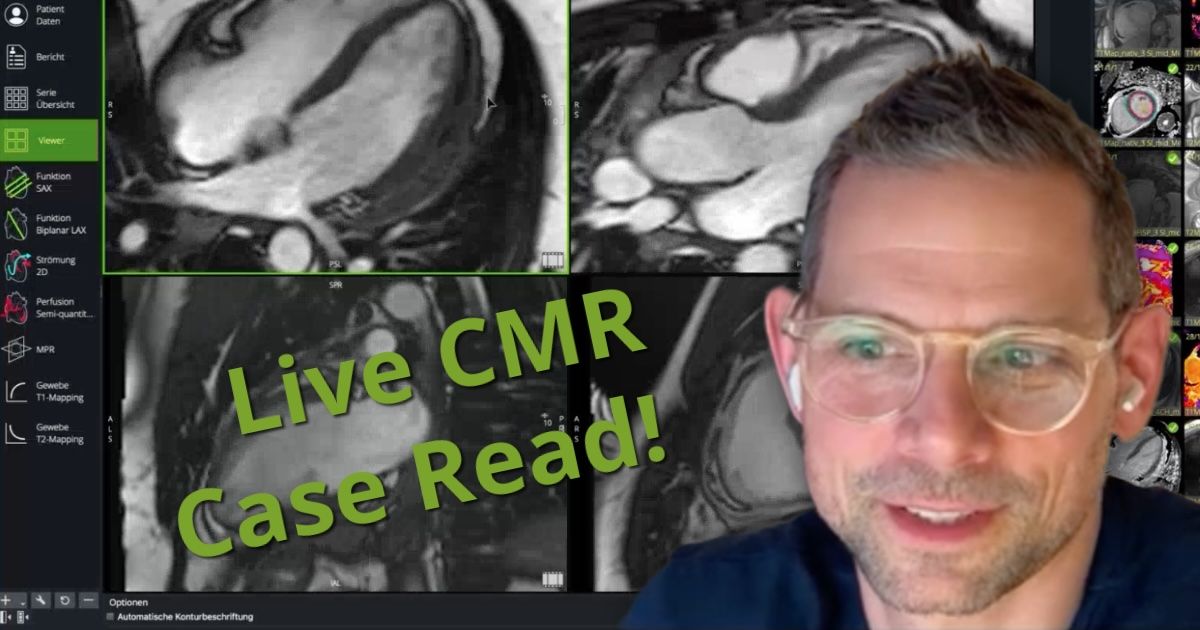 Cardiovascular Imaging Analysis | Circle CVI | Global