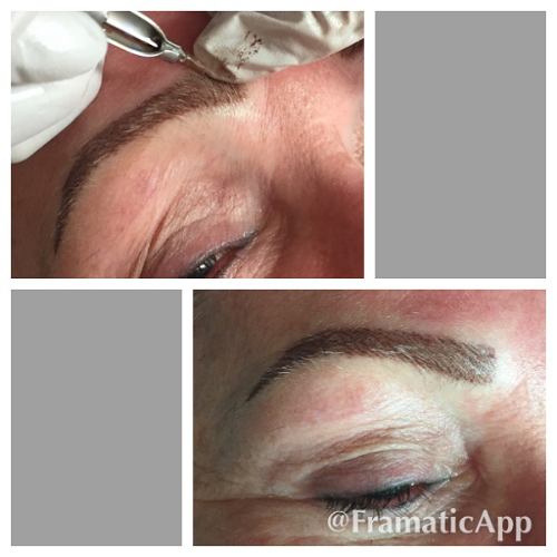A woman is getting her eyebrows tattooed with a machine.