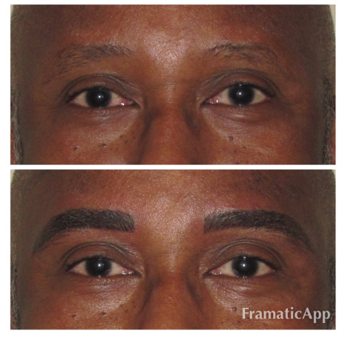 A before and after picture of a man 's eyebrows