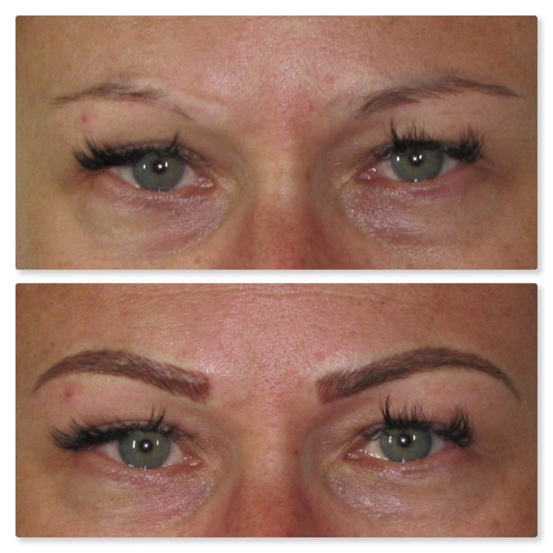 A before and after picture of a woman 's eyebrows