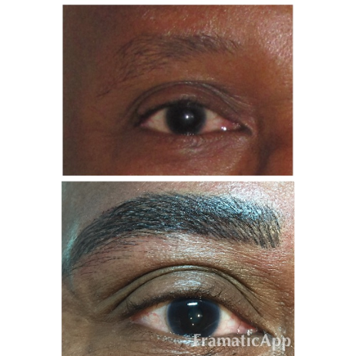 A before and after picture of a man 's eyebrows