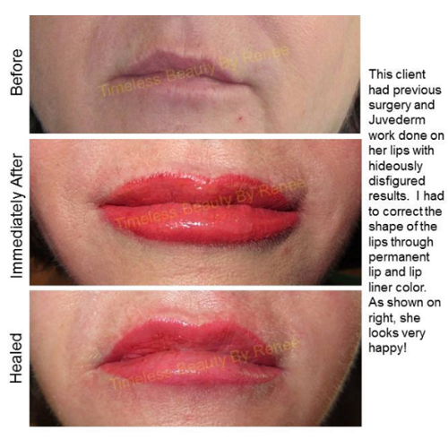A before and after photo of a woman 's lips with permanent lip and lip liner color