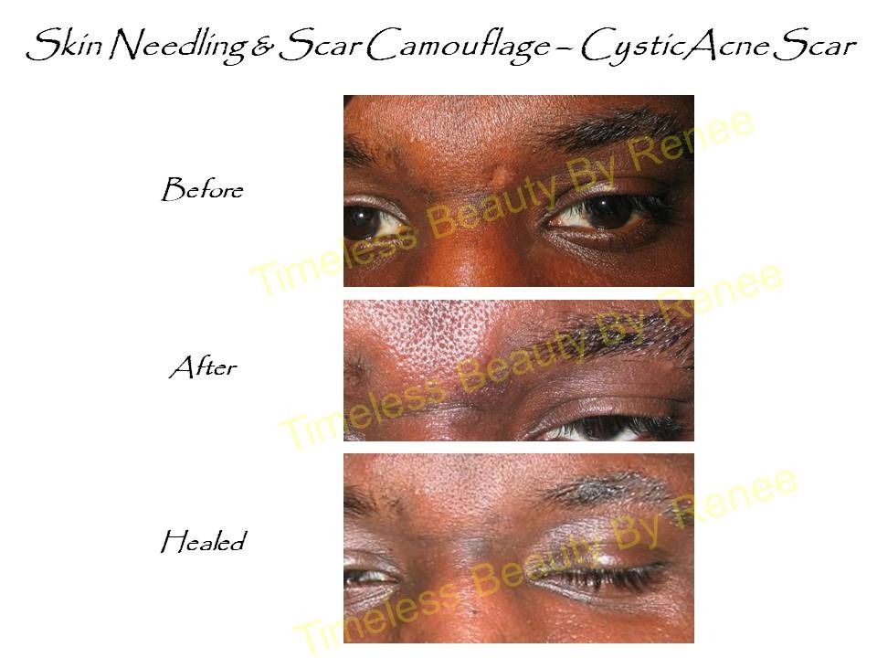 A before and after picture of a person 's face