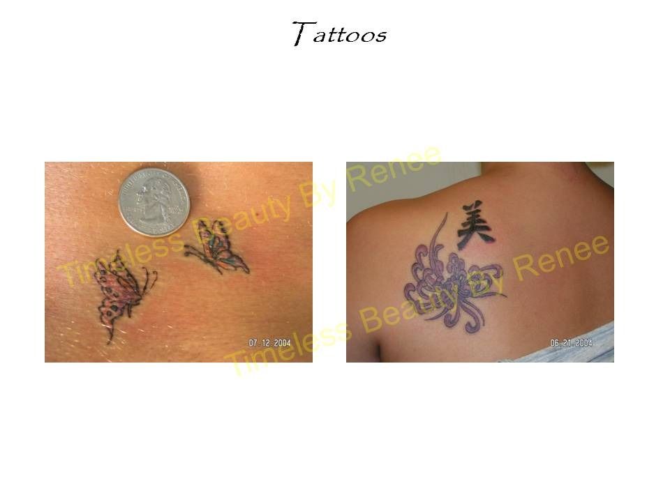A picture of a butterfly tattoo on a woman 's arm and a picture of a tattoo on a woman 's back