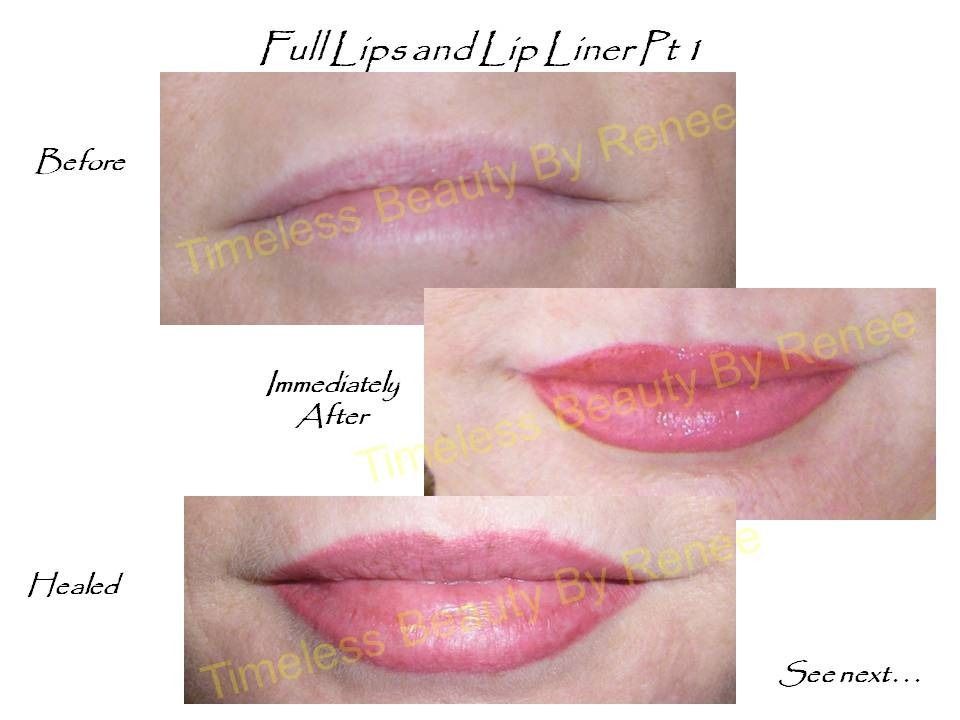 A before and after photo of full lips and lip liner
