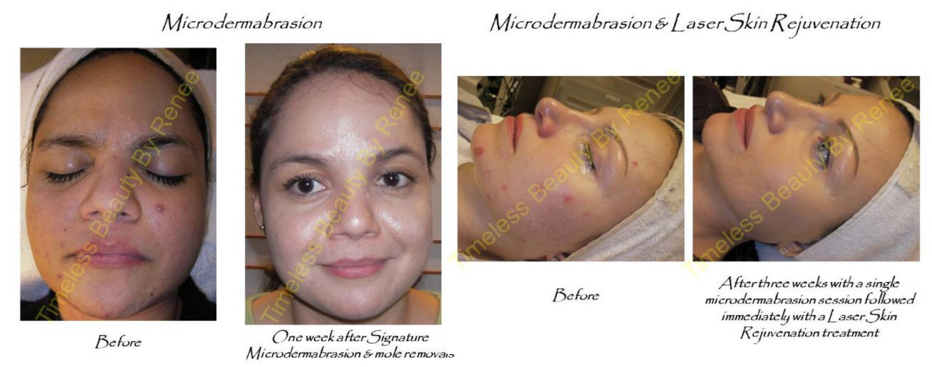 A before and after photo of a woman 's face