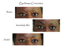 A before and after picture of a woman 's eyebrows correction.