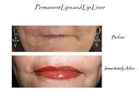 A before and after picture of a woman 's lips with permanent lip liner.