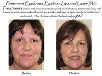 A before and after photo of a woman 's face with permanent eyebrows , eyeliner , lips and laser skin.