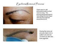 A woman is getting her eyebrows removed by a technician.