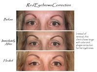 A before and after picture of a woman 's eyebrows.