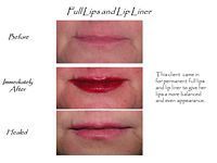 A before and after photo of a woman 's lips with full lips and lip liner.