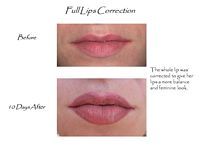 A before and after picture of a woman 's lips.