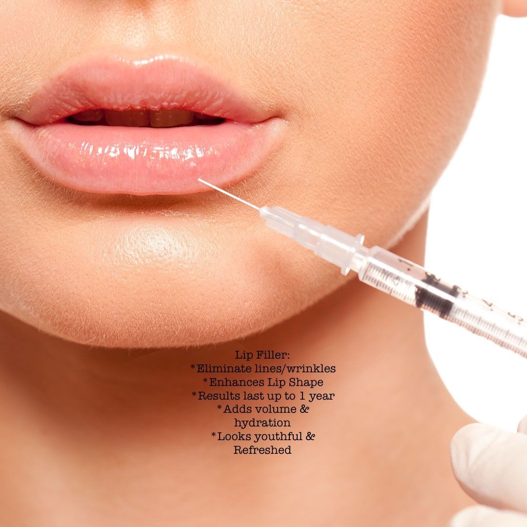 Close-up of lips with a syringe injecting filler near the mouth