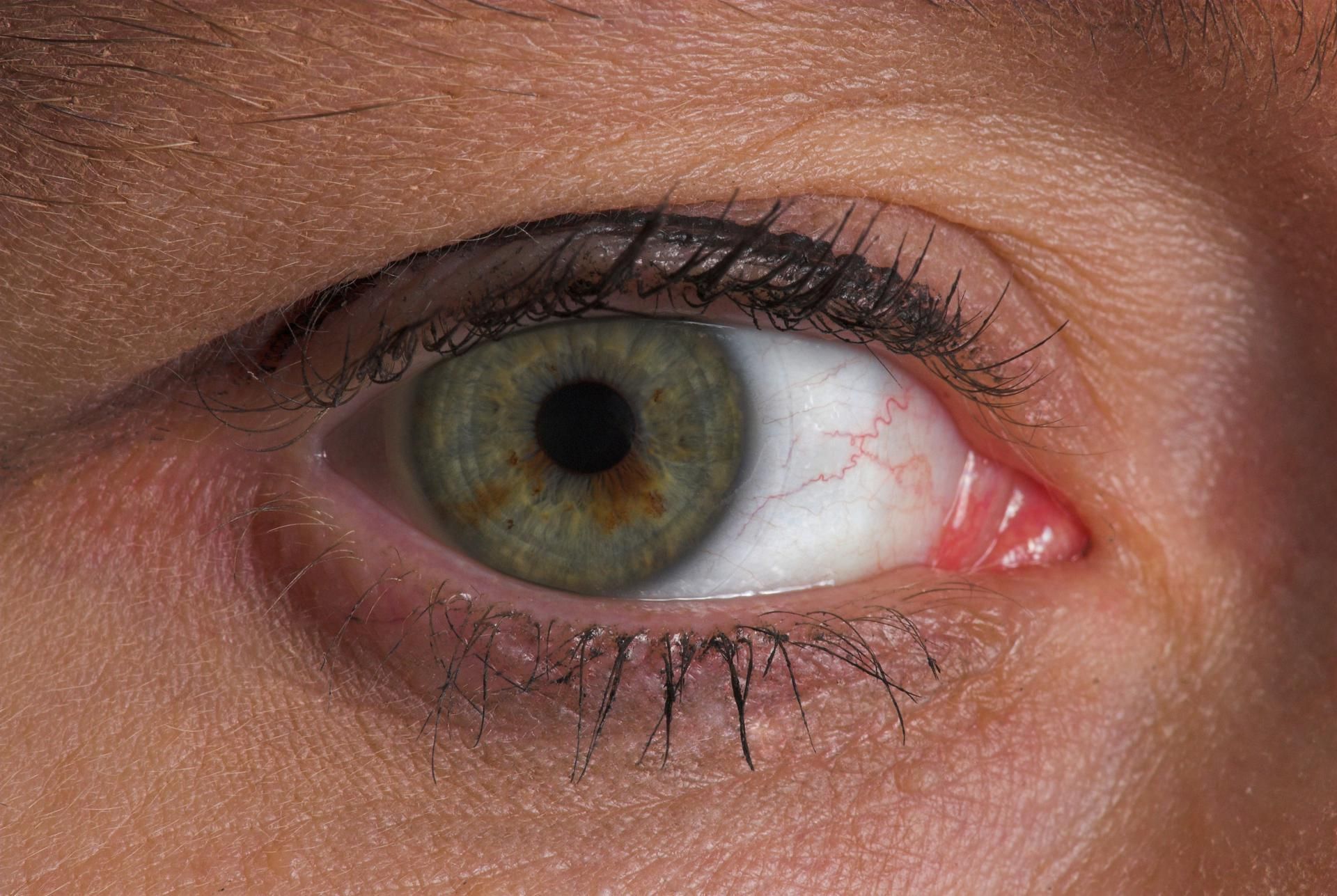 A close up of a person 's green eye with a red pupil.