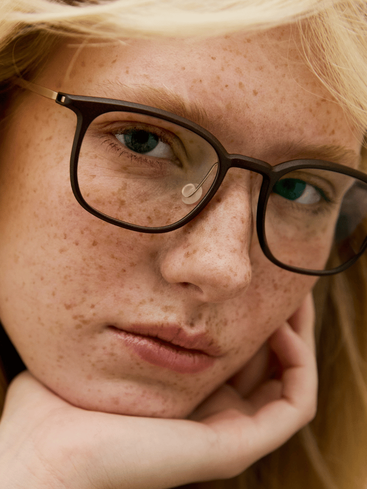 Close-up of a freckled face with glasses, resting on a hand, against a soft blurred background