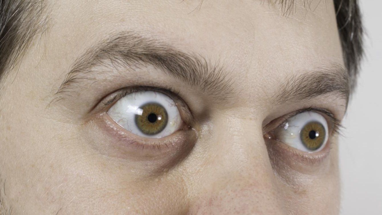 A close up of a man 's eyes with a surprised look on his face.