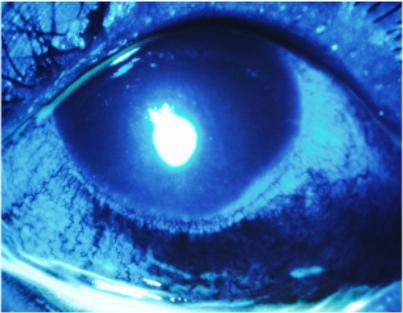 A close up of a blue eye with a white spot in the middle