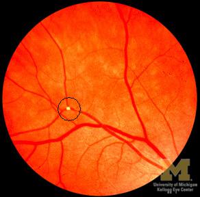 A picture of a person 's eye taken by the university of michigan
