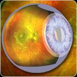 A computer generated image of a human eye showing the inside of the eye.