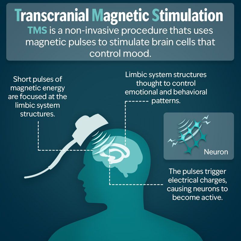Infographic showing how TMS therapy uses magnetic pulses to stimulate brain cells in the limbic system, aiding mood regulation.