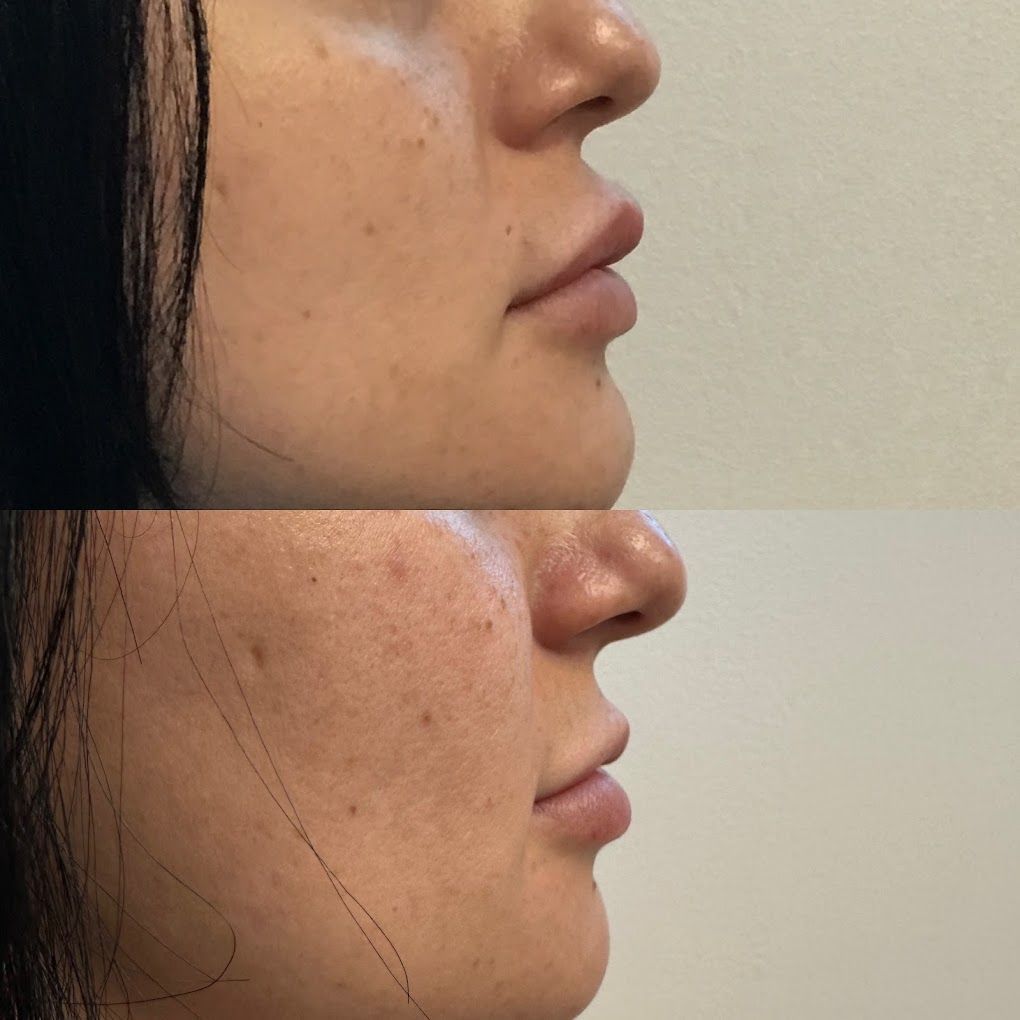 A before and after photo of a woman 's face.