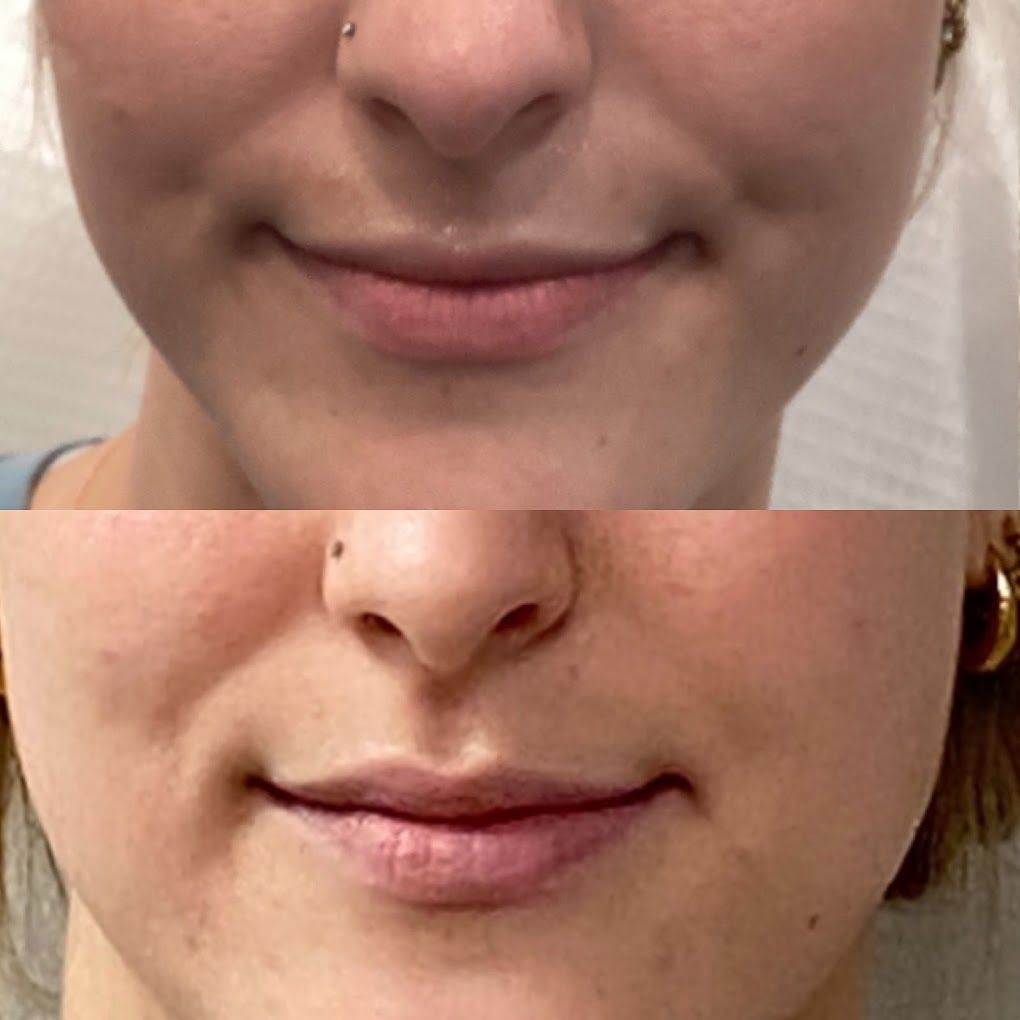 A before and after picture of a woman 's face.