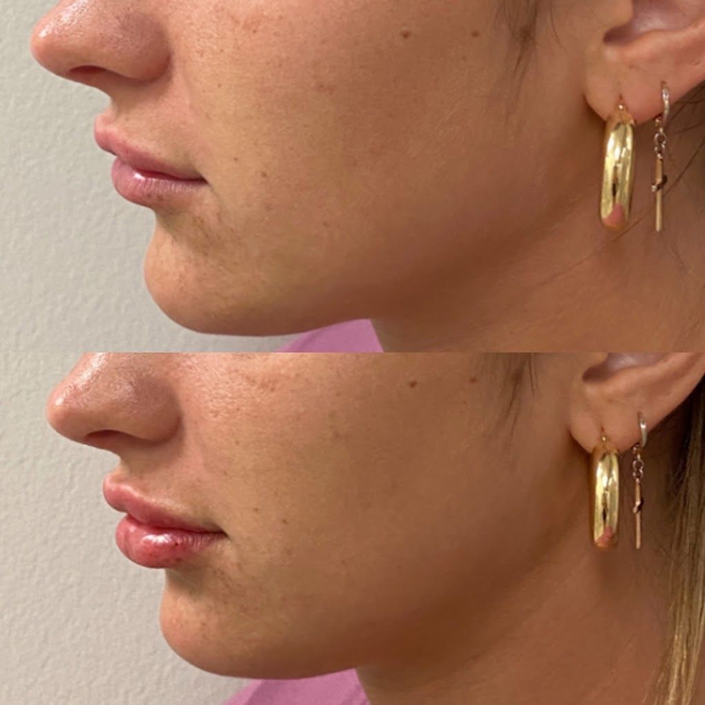 A before and after photo of a woman 's face with hoop earrings.