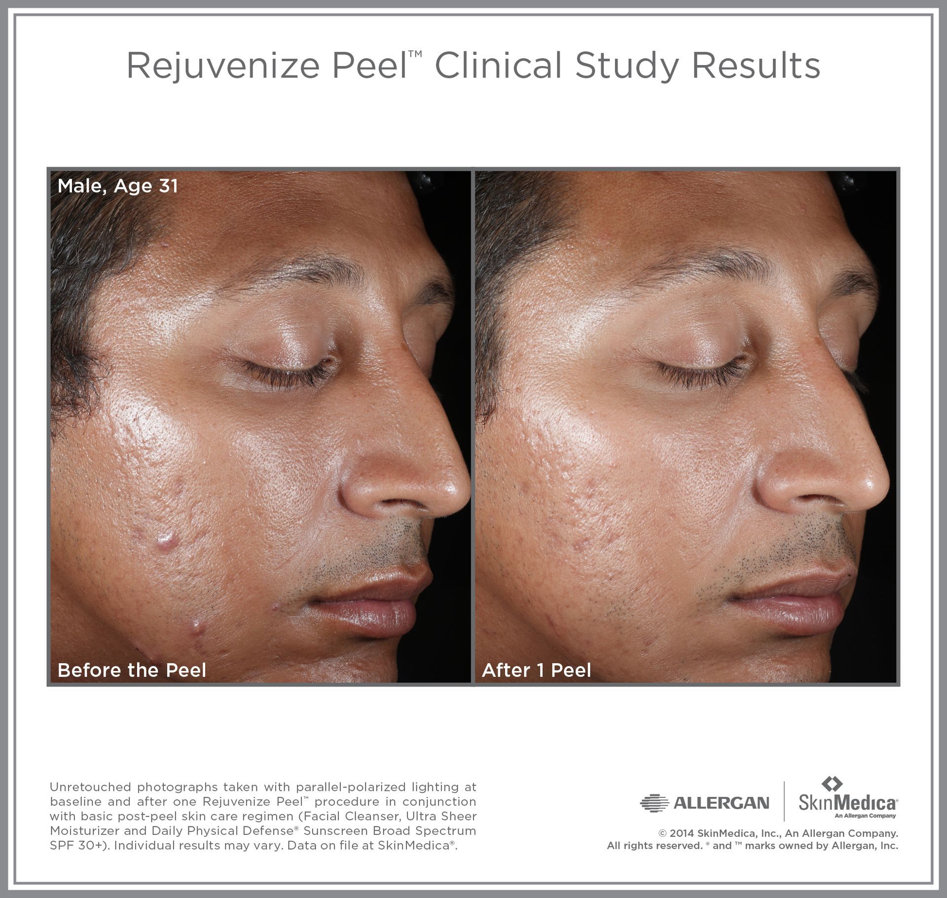 A before and after picture of a man 's face