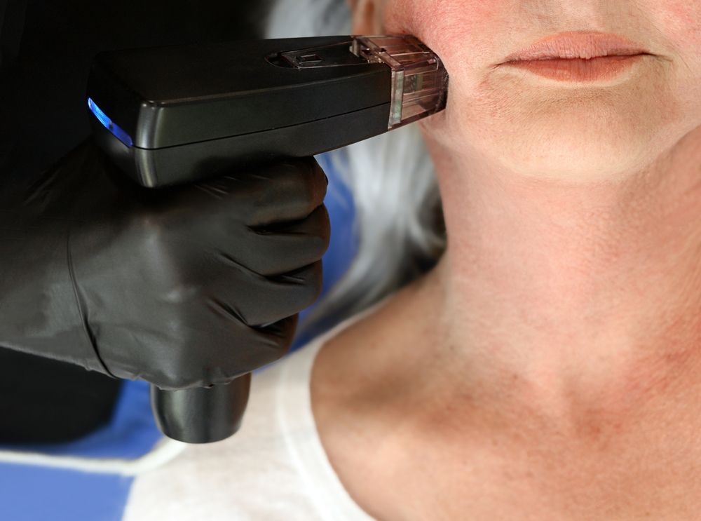 Hand in black glove using a device on a person’s cheek, possibly a cosmetic procedure.