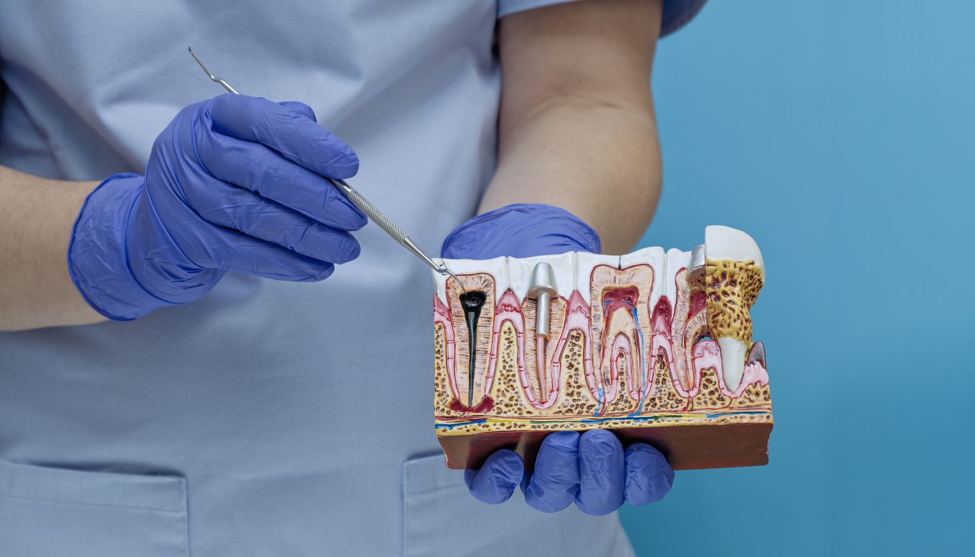 Dental professional holding a tooth anatomy model and pointing to a dental implant. Dental professional holding a tooth anatomy model and pointing to a dental implant.