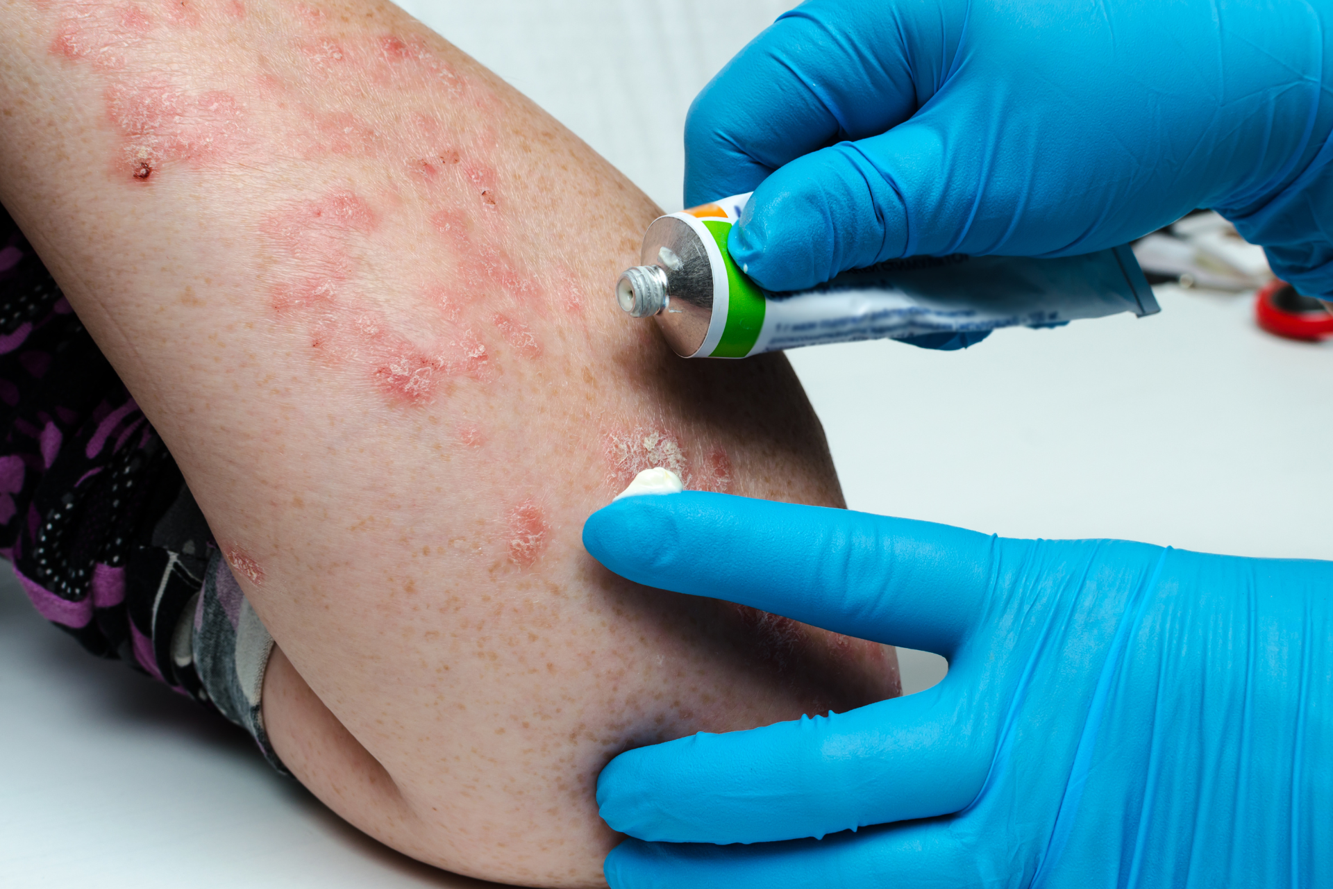 Dermatologist
