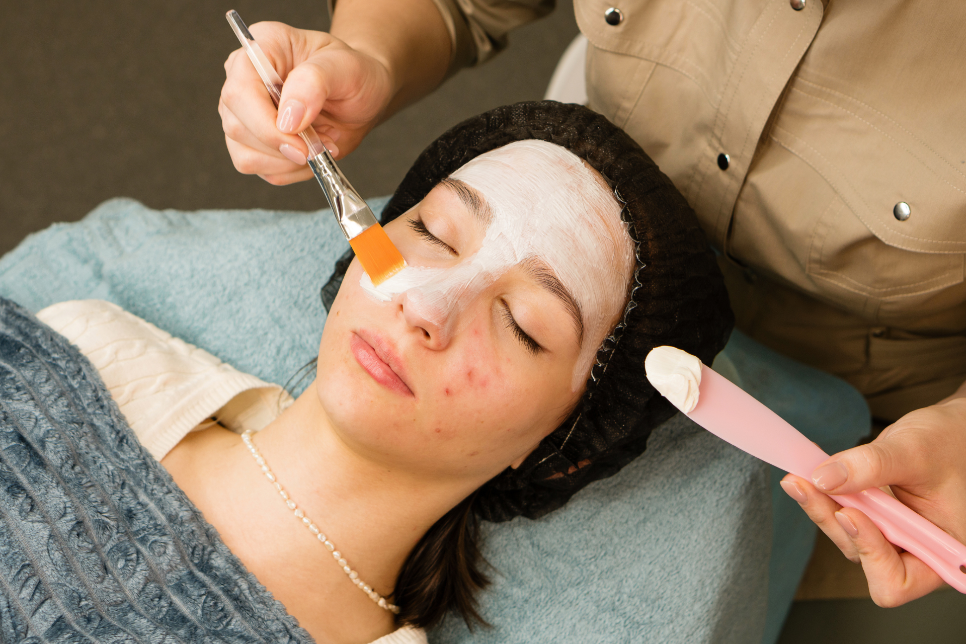 Professional Acne Treatments