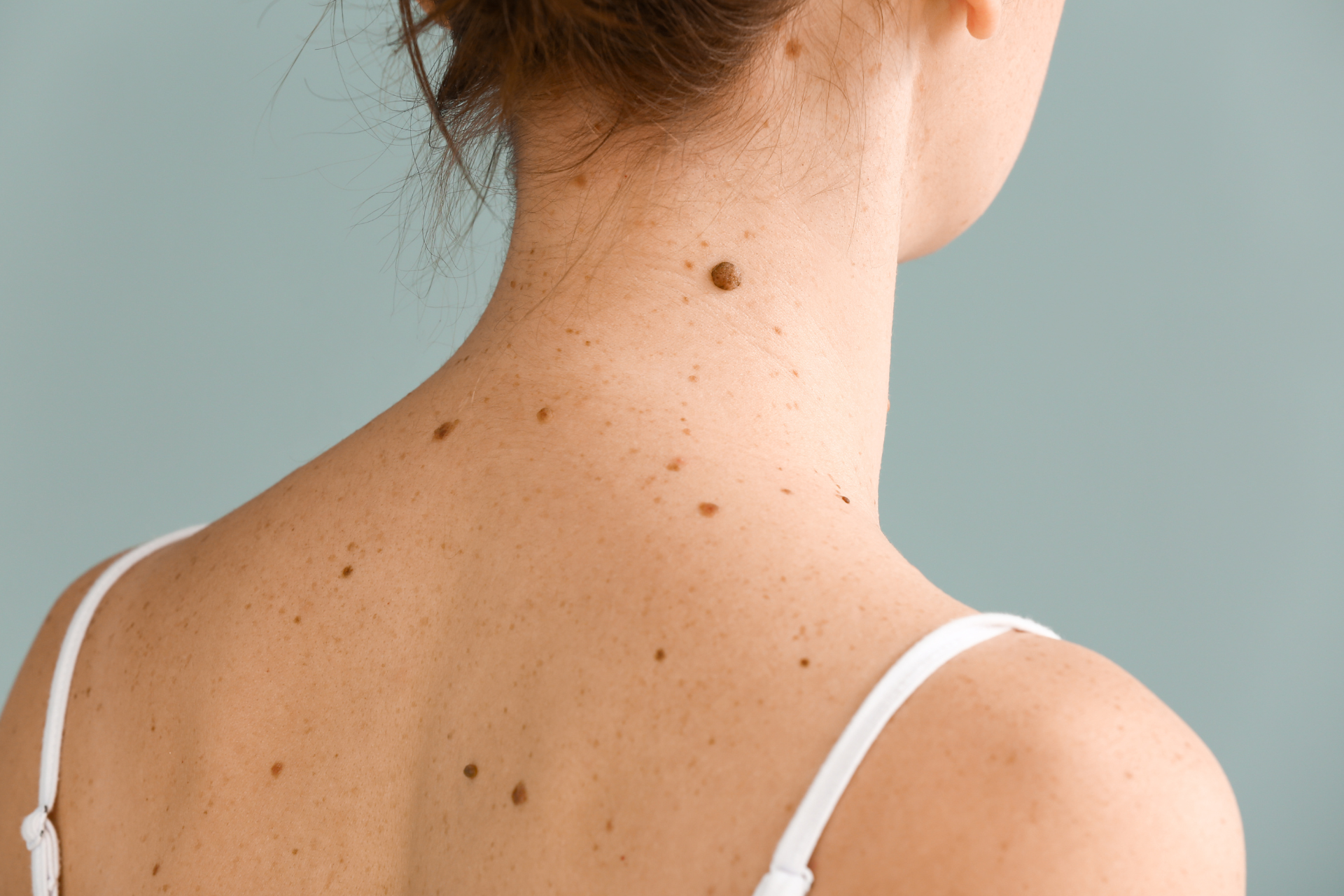 Moles