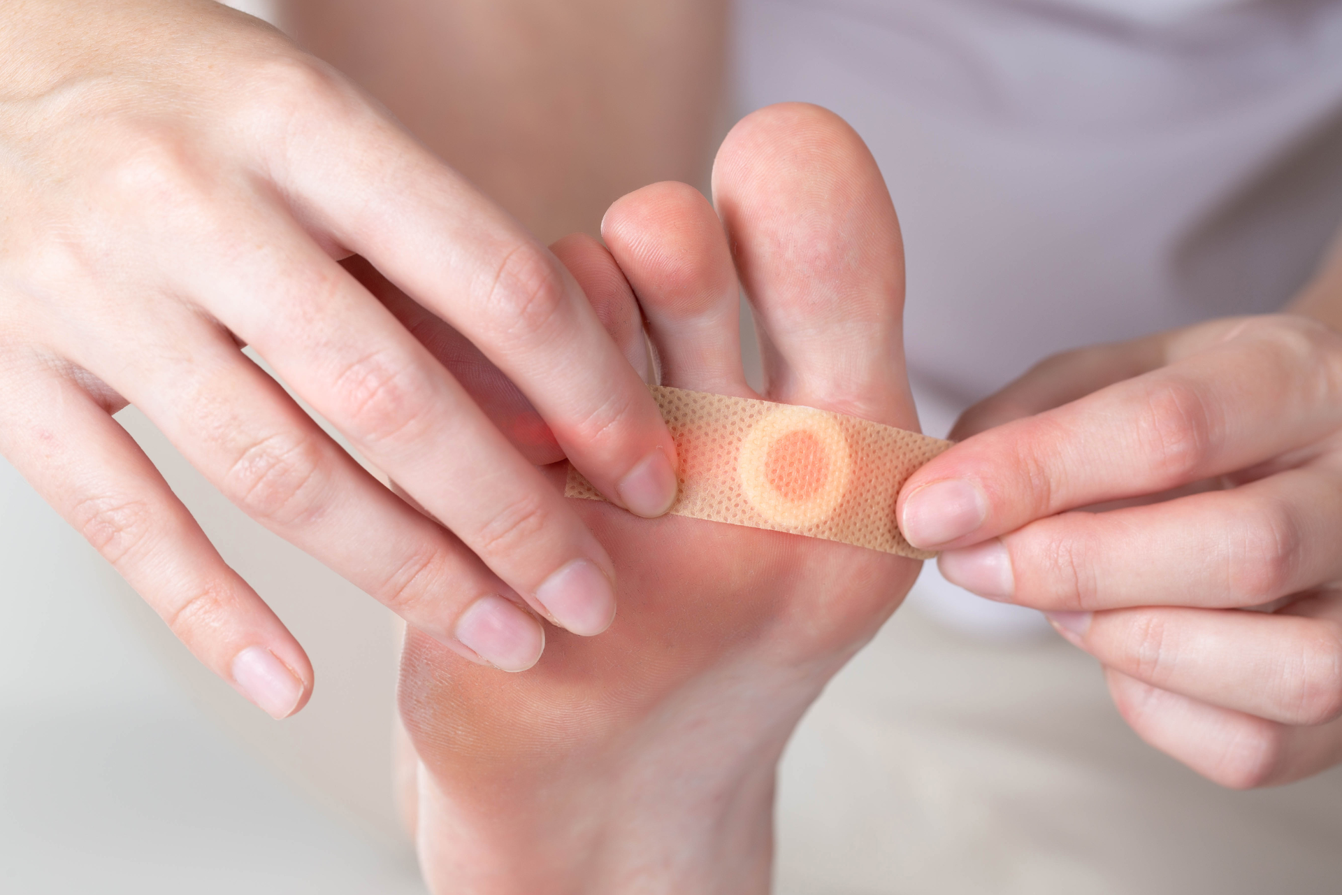 Wart Removal