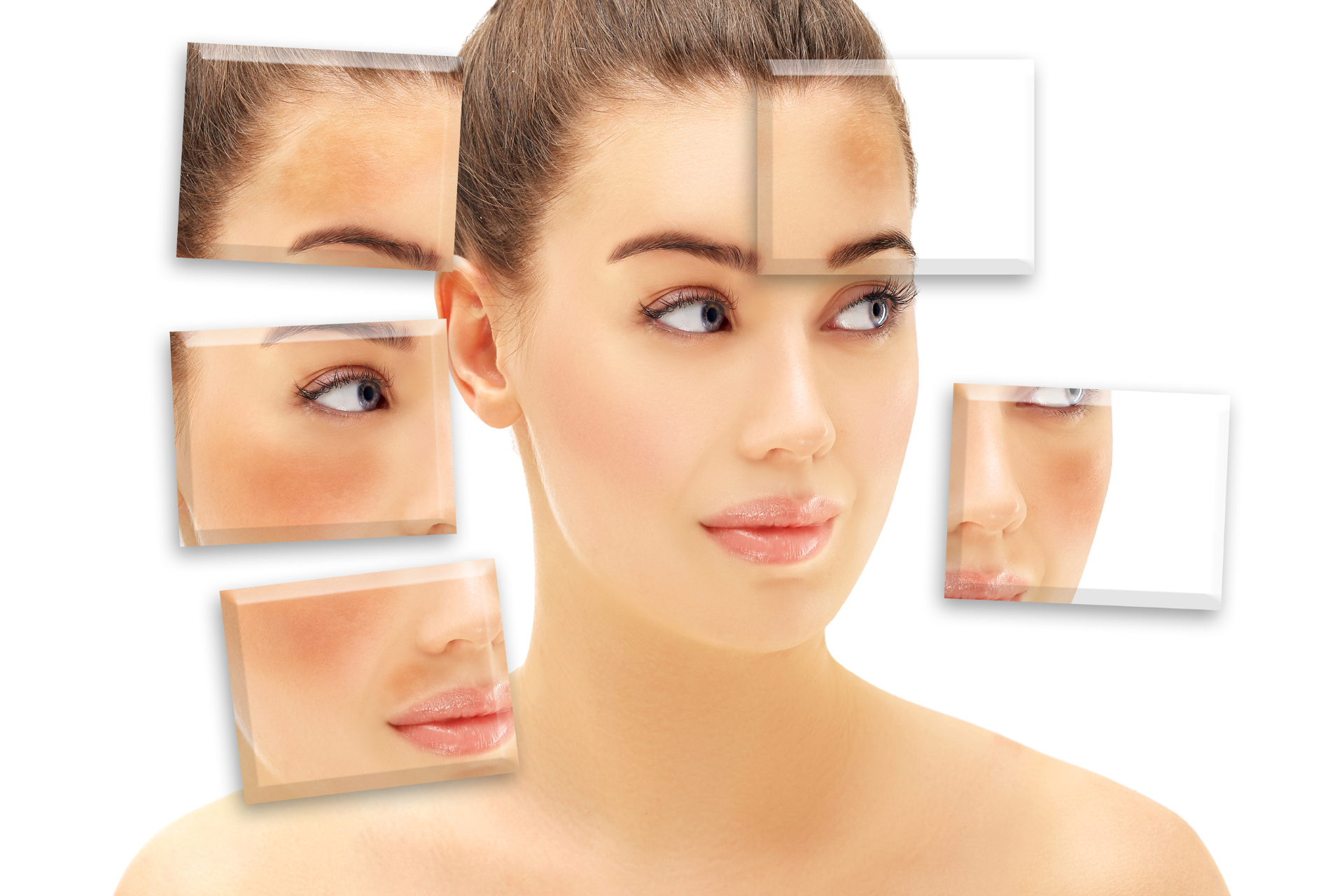 Hyperpigmentation