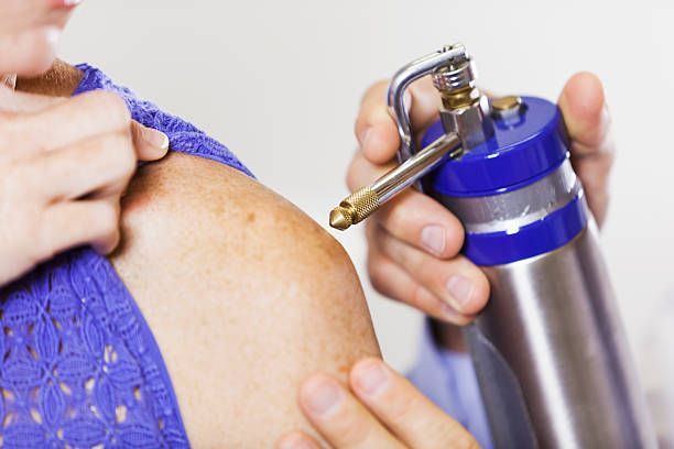 A woman is getting a cryotherapy treatment on her shoulder.