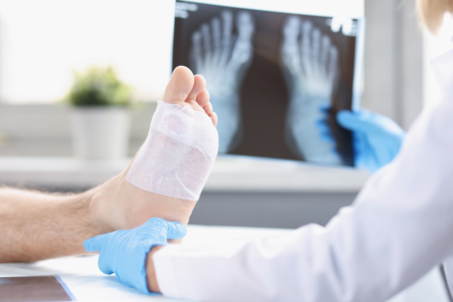 A Doctor Is Looking At An X-ray Of A Patient's Foot — Hastings Podiatry Centre In Port Macquarie, NSW
