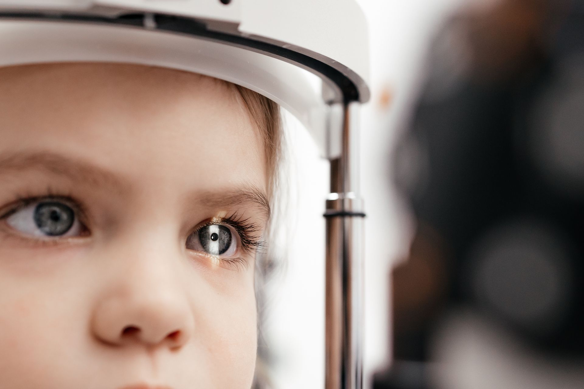 Catarata Congênita e Infantil