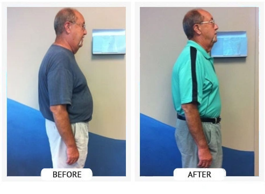 Before and After Dan O. lost 33 lbs and 29 inches in 42 days